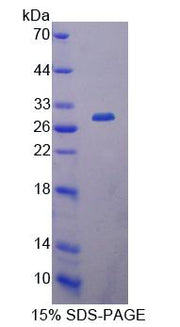Figure 1. SDS-PAGE