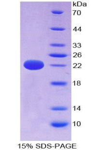 Figure 1. SDS-PAGE