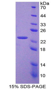 Figure 1. SDS-PAGE