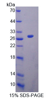 Figure 1. SDS-PAGE