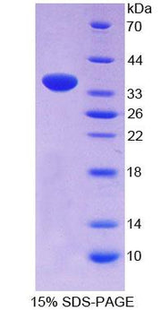 Figure 1. SDS-PAGE