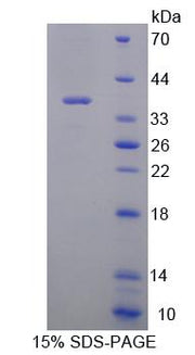 Figure 1. SDS-PAGE