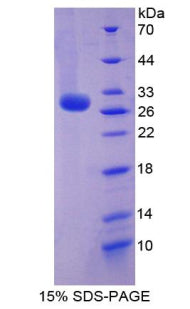 Figure 1. SDS-PAGE