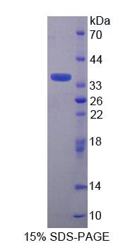 Figure 1. SDS-PAGE
