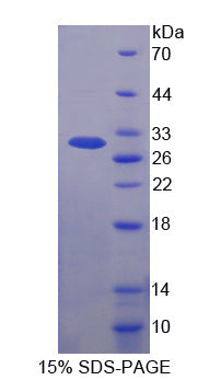 Figure 1. SDS-PAGE