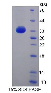Figure 1. SDS-PAGE