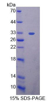 Figure 1. SDS-PAGE