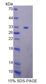 Figure 1. SDS-PAGE
