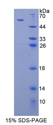 Figure 1. SDS-PAGE