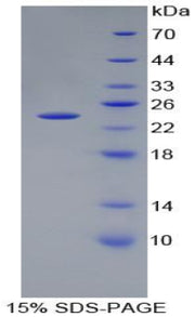 Figure 1. SDS-PAGE