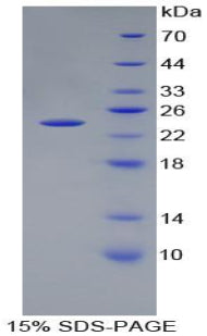 Figure 1. SDS-PAGE