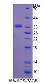 Figure 1. SDS-PAGE