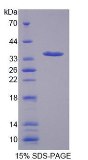 Figure 1. SDS-PAGE