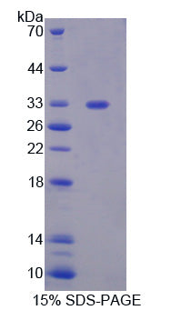 Figure 1. SDS-PAGE