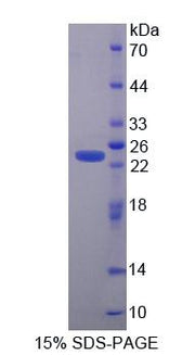 Figure 1. SDS-PAGE