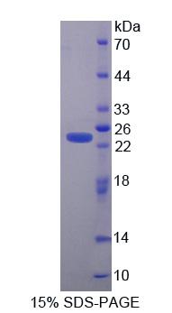 Figure 1. SDS-PAGE