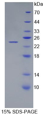Figure 1. SDS-PAGE