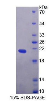 Figure 1. SDS-PAGE