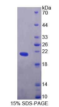 Figure 1. SDS-PAGE