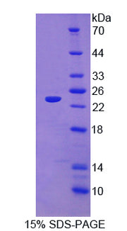 Figure 1. SDS-PAGE