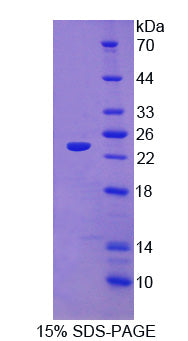 Figure 1. SDS-PAGE
