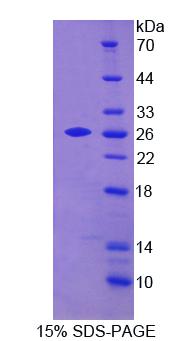 Figure 1. SDS-PAGE