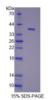 Figure 1. SDS-PAGE
