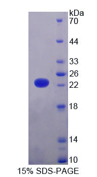 Figure 1. SDS-PAGE