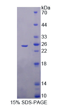 Figure 1. SDS-PAGE