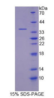 Figure 1. SDS-PAGE