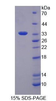 Figure 1. SDS-PAGE