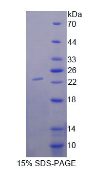 Figure 1. SDS-PAGE
