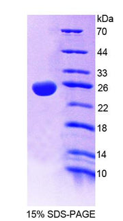 Figure 1. SDS-PAGE