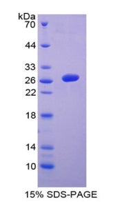 Figure 1. SDS-PAGE