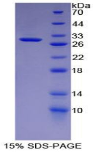 Figure 1. SDS-PAGE