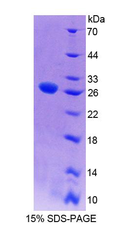 Figure 1. SDS-PAGE