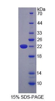 Figure 1. SDS-PAGE