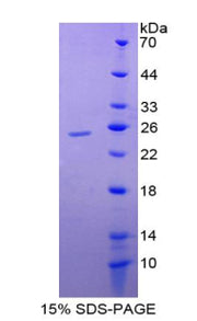 Figure 1. SDS-PAGE