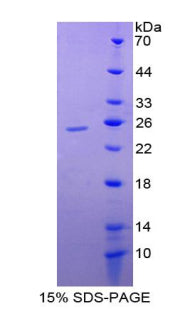Figure 1. SDS-PAGE