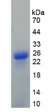 Figure 2. SDS-PAGE