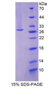 Figure 1. SDS-PAGE