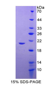 Figure 1. SDS-PAGE