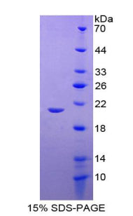 Figure 1. SDS-PAGE