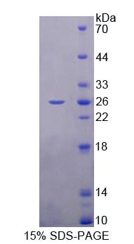 Figure 1. SDS-PAGE