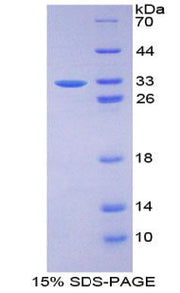 Figure 1. SDS-PAGE