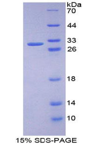 Figure 1. SDS-PAGE