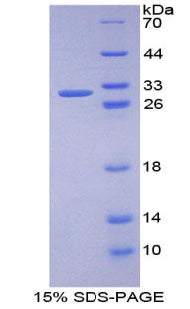 Figure 1. SDS-PAGE