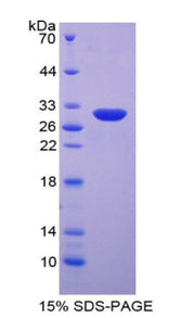 Figure 1. SDS-PAGE