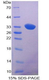 Figure 1. SDS-PAGE