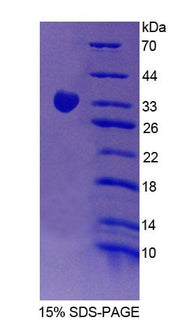 Figure 1. SDS-PAGE